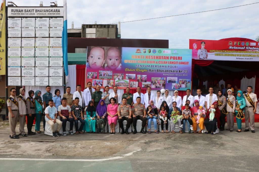 Hari Bhayangkara Ke-73, Biddokkes Polda Kaltim Gelar Operasi Bibir Sumbing IMG 20190618 WA0027